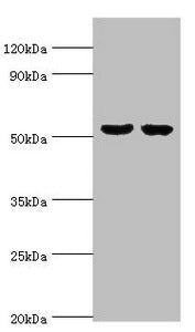 Western blot  | All lanes: GBA3 antibody at 10µg/ml  | Lane 1: Hela whole cell lysate  | Lane 2: HepG2 whole cell lysate  | Secondary  | Goat polyclonal to rabbit IgG at 1/10000 dilution  | Predicted band size: 54, 19 kDa  | Observed band size: 54 kDaRabbit anti-Human GBA3 Polyclonal Antibody