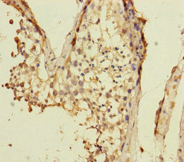 Immunohistochemistry of paraffin-embedded human testis tissue using VPS33B Antibody at dilution of 1:100Rabbit anti-Human VPS33B Polyclonal Antibody