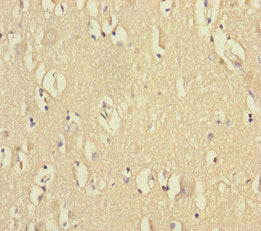 Immunohistochemistry of paraffin-embedded human brain tissue using VPS33B Antibody at dilution of 1:100Rabbit anti-Human VPS33B Polyclonal Antibody