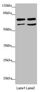 Western blot  | All lanes: VPS33B antibody at 2.72µg/ml  | Lane 1: Hela whole cell lysate  | Lane 2: A549 whole cell lysate  | Secondary  | Goat polyclonal to rabbit IgG at 1/10000 dilution  | Predicted band size: 71, 61 kDa  | Observed band size: 71, 61 kDaRabbit anti-Human VPS33B Polyclonal Antibody