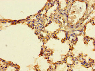 Immunohistochemistry of paraffin-embedded human lung tissue using IFI27L2 Antibody at dilution of 1:100Rabbit anti-Human IFI27L2 Polyclonal Antibody