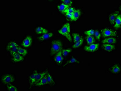 Immunofluorescence staining of HepG2 cells with LIME1 Antibody at 1:166, counter-stained with DAPI. The cells were fixed in 4% formaldehyde, permeabilized using 0.2% Triton X-100 and blocked in 10% normal Goat Serum. The cells were then incubated with the antibody overnight at 4°C. The secondary antibody was Alexa Fluor 488-congugated AffiniPure Goat Anti-Rabbit IgG(H+L).