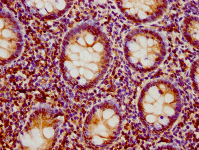 IHC image of LIME1 Antibody diluted at 1:500 and staining in paraffin-embedded human appendix tissue performed on a Leica BondTM system. After dewaxing and hydration, antigen retrieval was mediated by high pressure in a citrate buffer (pH 6.0). Section was blocked with 10% normal goat serum 30min at RT. Then primary antibody (1% BSA) was incubated at 4°C overnight. The primary is detected by a biotinylated secondary antibody and visualized using an HRP conjugated SP system.