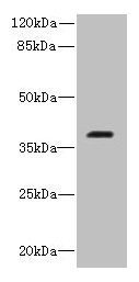 Western blot | All lanes: RIBC2 antibody at 0.8μg/ml + Caco-2 whole cell lysate | Secondary | Goat polyclonal to rabbit IgG at 1/10000 dilution | Predicted band size: 38 kDa | Observed band size: 38 kDaRabbit anti-Human RIBC2 Polyclonal Antibody