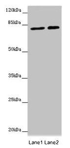 Western blot  | All lanes: DHX33 antibody at 16µg/ml  | Lane 1: Hela whole cell lysate  | Lane 2: 293T whole cell lysate  | Secondary  | Goat polyclonal to rabbit IgG at 1/10000 dilution  | Predicted band size: 79, 61 kDa  | Observed band size: 79 kDaRabbit anti-Human DHX33 Polyclonal Antibody