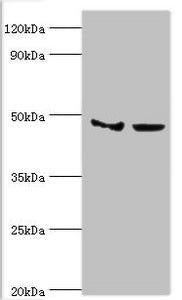Western blot | All lanes: Histone-lysine N-methyltransferase SMYD3 antibody at 3μg/ml | Lane 1: Hela whole cell lysate | Lane 2: HepG2 whole cell lysate | Secondary | Goat polyclonal to rabbit IgG at 1/10000 dilution | Predicted band size: 50, 30, 43 kDa | Observed band size: 50 kDaRabbit anti-Human SMYD3 Polyclonal Antibody