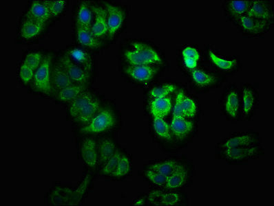 Immunofluorescence staining of HepG2 cells with YY1AP1 Antibody at 1:100, counter-stained with DAPI. The cells were fixed in 4% formaldehyde, permeabilized using 0.2% Triton X-100 and blocked in 10% normal Goat Serum. The cells were then incubated with the antibody overnight at 4°C. The secondary antibody was Alexa Fluor 488-congugated AffiniPure Goat Anti-Rabbit IgG(H+L).Rabbit anti-Human YY1AP1 Polyclonal Antibody