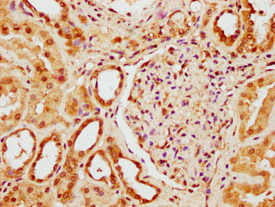 IHC image of the antibody diluted at 1:300 and staining in paraffin-embedded human kidney tissue performed on a Leica BondTM system. After dewaxing and hydration, antigen retrieval was mediated by high pressure in a citrate buffer (pH 6.0). Section was blocked with 10% normal goat serum 30min at RT. Then primary antibody (1% BSA) was incubated at 4°C overnight. The primary is detected by a biotinylated secondary antibody and visualized using an HRP conjugated SP system.Rabbit anti-Human YY1AP1 Polyclonal Antibody