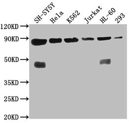 Western Blot  | Positive WB detected in: SH-SY5Y whole cell lysate, Hela whole cell lysate, K562 whole cell lysate, Jurkat whole cell lysate, HL60 whole cell lysate, 293 whole cell lysate  | All lanes: YY1AP1 antibody at 1:2000  | Secondary  | Goat polyclonal to rabbit IgG at 1/50000 dilution  | Predicted band size: 88, 84, 82, 81, 76, 80, 51, 96, 98 kDa  | Observed band size: 88 kDaRabbit anti-Human YY1AP1 Polyclonal Antibody