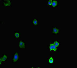 Immunofluorescent analysis of HepG2 cells using ACTR5 Antibody at dilution of 1:100 and Alexa Fluor 488-congugated AffiniPure Goat Anti-Rabbit IgG(H+L)Rabbit anti-Human ACTR5 Polyclonal Antibody