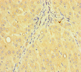 Immunohistochemistry of paraffin-embedded human liver tissue using the antibody at dilution of 1:100