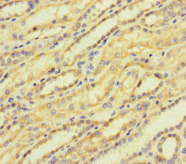 Immunohistochemistry of paraffin-embedded human kidney tissue using ACTR5 Antibody at dilution of 1:100Rabbit anti-Human ACTR5 Polyclonal Antibody