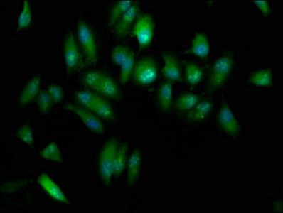 Immunofluorescence staining of Hela cells with ELP3 Antibody at 1:133, counter-stained with DAPI. The cells were fixed in 4% formaldehyde, permeabilized using 0.2% Triton X-100 and blocked in 10% normal Goat Serum. The cells were then incubated with the antibody overnight at 4°C. The secondary antibody was Alexa Fluor 488-congugated AffiniPure Goat Anti-Rabbit IgG(H+L).Rabbit anti-Human ELP3 Polyclonal Antibody