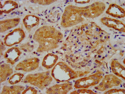 IHC image of ELP3 Antibody diluted at 1:400 and staining in paraffin-embedded human kidney tissue performed on a Leica BondTM system. After dewaxing and hydration, antigen retrieval was mediated by high pressure in a citrate buffer (pH 6.0). Section was blocked with 10% normal goat serum 30min at RT. Then primary antibody (1% BSA) was incubated at 4°C overnight. The primary is detected by a biotinylated secondary antibody and visualized using an HRP conjugated SP system.Rabbit anti-Human ELP3 Polyclonal Antibody