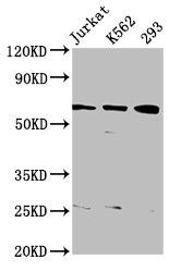 Western Blot  | Positive WB detected in: Jurkat whole cell lysate, K562 whole cell lysate, 293 whole cell lysate  | All lanes: ELP3 antibody at 3.82µg/ml  | Secondary  | Goat polyclonal to rabbit IgG at 1/50000 dilution  | Predicted band size: 63, 61, 50, 53 kDa  | Observed band size: 63 kDaRabbit anti-Human ELP3 Polyclonal Antibody