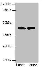 Western blot | All lanes: NMUR1 antibody at 2μg/ml | Lane 1: Mouse liver tissue | Lane 2: Mouse kidney tissue | Secondary | Goat polyclonal to rabbit IgG at 1/10000 dilution | Predicted band size: 47 kDa | Observed band size: 47 kDaRabbit anti-Human NMUR1 Polyclonal Antibody