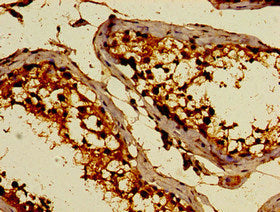 Immunohistochemistry of paraffin-embedded human testis tissue using C3orf14 Antibody at dilution of 1:100