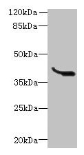 Western blot | All lanes: LRTM1 antibody at 0.4μg/ml + K562 whole cell lysate | Secondary | Goat polyclonal to rabbit IgG at 1/10000 dilution | Predicted band size: 39, 30 kDa | Observed band size: 39 kDa