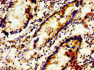 Immunohistochemistry of paraffin-embedded human appendix tissue using LGR6 Antibody at dilution of 1:100