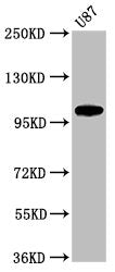 Western Blot  | Positive WB detected in: U87 whole cell lysate  | All lanes: LGR6 antibody at 2.5µg/ml  | Secondary  | Goat polyclonal to rabbit IgG at 1/50000 dilution  | Predicted band size: 105, 90, 100 kDa  | Observed band size: 105 kDa