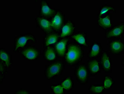 Immunofluorescence staining of A549 cells with BCL2L10 Antibody at 1:50, counter-stained with DAPI. The cells were fixed in 4% formaldehyde, permeabilized using 0.2% Triton X-100 and blocked in 10% normal Goat Serum. The cells were then incubated with the antibody overnight at 4°C. The secondary antibody was Alexa Fluor 488-congugated AffiniPure Goat Anti-Rabbit IgG(H+L).