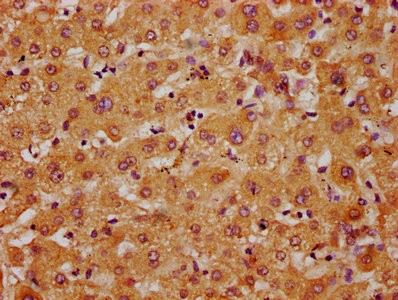 IHC image of APMAP Antibody diluted at 1:400 and staining in paraffin-embedded human liver tissue performed on a Leica BondTM system. After dewaxing and hydration, antigen retrieval was mediated by high pressure in a citrate buffer (pH 6.0). Section was blocked with 10% normal goat serum 30min at RT. Then primary antibody (1% BSA) was incubated at 4°C overnight. The primary is detected by a biotinylated secondary antibody and visualized using an HRP conjugated SP system.Rabbit anti-Human APMAP Polyclonal Antibody