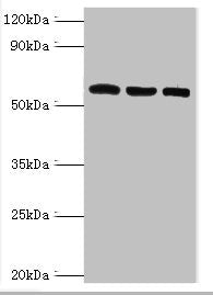 Western blot | All lanes: Thioredoxin reductase 2, mitochondrial antibody at 6μg/ml | Lane 1: Mouse liver tissue | Lane 2: Mouse gonad tissue | Lane 3: Hela whole cell lysate | Secondary | Goat polyclonal to rabbit IgG at 1/10000 dilution | Predicted band size: 57, 54, 47, 31 kDa | Observed band size: 57 kDaRabbit anti-Human TXNRD2 Polyclonal Antibody