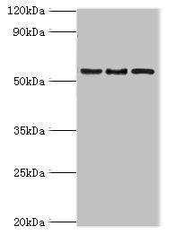 Western blot | All lanes: ARFGAP3 antibody at 4μg/ml | Lane 1: HepG2 whole cell lysate | Lane 2: Jurkat whole cell lysate | Lane 3: A549 whole cell lysate | Secondary | Goat polyclonal to rabbit IgG at 1/10000 dilution | Predicted band size: 57, 52 kDa | Observed band size: 57 kDaRabbit anti-Human ARFGAP3 Polyclonal Antibody