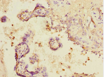 Immunohistochemistry of paraffin-embedded human placenta tissue using DCP1A Antibody at dilution of 1:100Rabbit anti-Human DCP1A Polyclonal Antibody