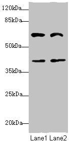 Western blot | All lanes: DCP1A antibody at 3.79μg/ml | Lane 1: Jurkat whole cell lysate | Lane 2: HepG2 whole cell lysate | Secondary | Goat polyclonal to rabbit IgG at 1/10000 dilution | Predicted band size: 64, 60 kDa | Observed band size: 64, 40 kDaRabbit anti-Human DCP1A Polyclonal Antibody