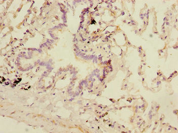 Immunohistochemistry of paraffin-embedded human lung tissue using DCP1A Antibody at dilution of 1:100Rabbit anti-Human DCP1A Polyclonal Antibody