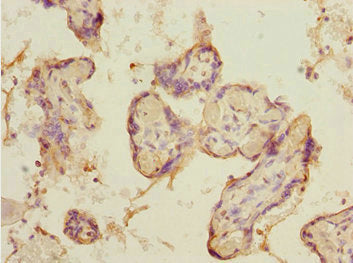 Immunohistochemistry of paraffin-embedded human placenta tissue using DCP1A Antibody at dilution of 1:100Rabbit anti-Human DCP1A Polyclonal Antibody
