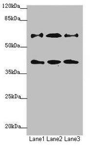 Western blot | All lanes: DCP1A antibody at 1.23μg/ml | Lane 1: Jurkat whole cell lysate | Lane 2: 293T whole cell lysate | Lane 3: HepG2 whole cell lysate | Secondary | Goat polyclonal to rabbit IgG at 1/10000 dilution | Predicted band size: 64, 60 kDa | Observed band size: 64, 40 kDaRabbit anti-Human DCP1A Polyclonal Antibody