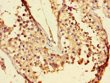 Immunohistochemistry of paraffin-embedded human testis tissue using LZTFL1 Antibody at dilution of 1:100
