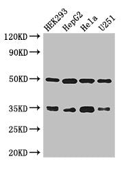 Western Blot  | Positive WB detected in: HEK293 whole cell lysate, HepG2 whole cell lysate, Hela whole cell lysate, U251 whole cell lysate  | All lanes: LZTFL1 antibody at 3µg/ml  | Secondary  | Goat polyclonal to rabbit IgG at 1/50000 dilution  | Predicted band size: 35, 33, 30 kDa  | Observed band size: 35, 50 kDa