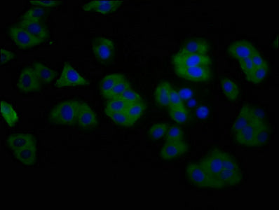 Immunofluorescence staining of HepG2 cells with ANO2 Antibody at 1:200, counter-stained with DAPI. The cells were fixed in 4% formaldehyde, permeabilized using 0.2% Triton X-100 and blocked in 10% normal Goat Serum. The cells were then incubated with the antibody overnight at 4°C. The secondary antibody was Alexa Fluor 488-congugated AffiniPure Goat Anti-Rabbit IgG(H+L).Rabbit anti-Human ANO2 Polyclonal Antibody