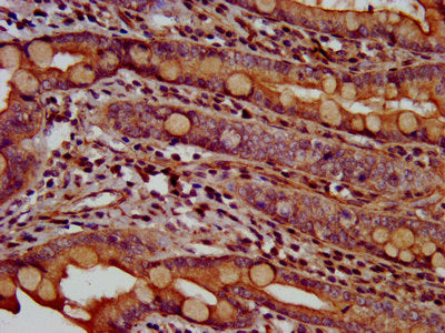 IHC image of ANO2 Antibody diluted at 1:600 and staining in paraffin-embedded human small intestine tissue performed on a Leica BondTM system. After dewaxing and hydration, antigen retrieval was mediated by high pressure in a citrate buffer (pH 6.0). Section was blocked with 10% normal goat serum 30min at RT. Then primary antibody (1% BSA) was incubated at 4°C overnight. The primary is detected by a biotinylated secondary antibody and visualized using an HRP conjugated SP system.Rabbit anti-Human ANO2 Polyclonal Antibody