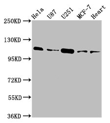 Western Blot  | Positive WB detected in: Hela whole cell lysate, U87 whole cell lysate, U251 whole cell lysate, MCF-7 whole cell lysate, Rat heart tissue  | All lanes: ANO2 antibody at 3.9µg/ml  | Secondary  | Goat polyclonal to rabbit IgG at 1/50000 dilution  | Predicted band size: 114 kDa  | Observed band size: 114 kDaRabbit anti-Human ANO2 Polyclonal Antibody
