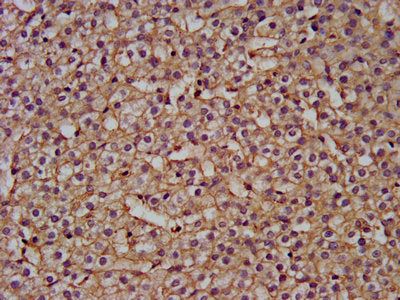 IHC image of NANS Antibody diluted at 1:200 and staining in paraffin-embedded human adrenal gland tissue performed on a Leica BondTM system. After dewaxing and hydration, antigen retrieval was mediated by high pressure in a citrate buffer (pH 6.0). Section was blocked with 10% normal goat serum 30min at RT. Then primary antibody (1% BSA) was incubated at 4°C overnight. The primary is detected by a biotinylated secondary antibody and visualized using an HRP conjugated SP system.Rabbit anti-Human NANS Polyclonal Antibody