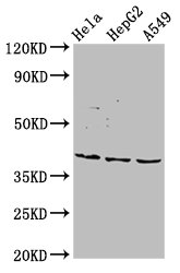 Western Blot | Positive WB detected in: Hela whole cell lysate, HepG2 whole cell lysate, A549 whole cell lysate | All lanes: NANS antibody at 5.5μg/ml | Secondary | Goat polyclonal to rabbit IgG at 1/50000 dilution | Predicted band size: 41 kDa | Observed band size: 41 kDaRabbit anti-Human NANS Polyclonal Antibody