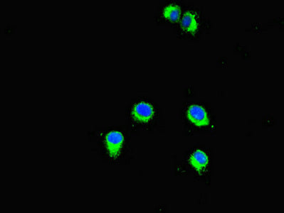 Immunofluorescent analysis of Hela cells using SMYD2 Antibody at dilution of 1:100 and Alexa Fluor 488-congugated AffiniPure Goat Anti-Rabbit IgG(H+L)Rabbit anti-Human SMYD2 Polyclonal Antibody