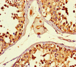 Immunohistochemistry of paraffin-embedded human testis tissue using the antibody at dilution of 1:100Rabbit anti-Human SMYD2 Polyclonal Antibody