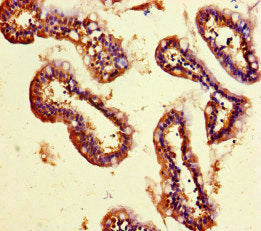 Immunohistochemistry of paraffin-embedded human small intestine tissue using SMYD2 Antibody at dilution of 1:100Rabbit anti-Human SMYD2 Polyclonal Antibody
