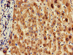 Immunohistochemistry of paraffin-embedded human liver tissue using OLFML3 Antibody at dilution of 1:100Rabbit anti-Human OLFML3 Polyclonal Antibody