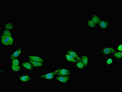 Immunofluorescent analysis of HepG2 cells using SMC4 Antibody at dilution of 1:100 and Alexa Fluor 488-congugated AffiniPure Goat Anti-Rabbit IgG(H+L)Rabbit anti-Human SMC4 Polyclonal Antibody