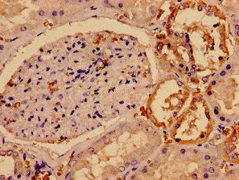 Immunocytochemistry analysis of human kidney tissue using SMC4 Antibody at dilution of 1:100Rabbit anti-Human SMC4 Polyclonal Antibody