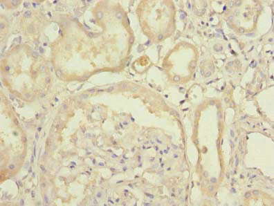 Immunohistochemistry of paraffin-embedded human kidney tissue using UFSP2 Antibody at dilution of 1:100Rabbit anti-Human UFSP2 Polyclonal Antibody