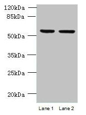 Western blot | All lanes: UFSP2 antibody at 4μg/ml | Lane 1: HepG2 whole cell lysate | Lane 2: NIH/3T3 whole cell lysate | Secondary | Goat polyclonal to rabbit IgG at 1/10000 dilution | Predicted band size: 54 kDa | Observed band size: 54 kDaRabbit anti-Human UFSP2 Polyclonal Antibody