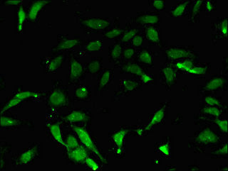 Immunofluorescent analysis of Hela cells using PRMT7 Antibody at dilution of 1:100 and Alexa Fluor 488-congugated AffiniPure Goat Anti-Rabbit IgG(H+L)Rabbit anti-Human PRMT7 Polyclonal Antibody