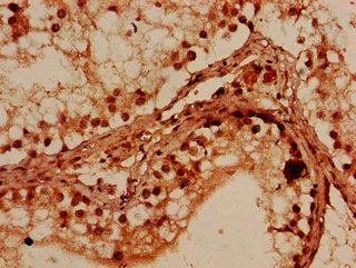 Immunohistochemistry of paraffin-embedded human testis tissue using PRMT7 Antibody at dilution of 1:100Rabbit anti-Human PRMT7 Polyclonal Antibody